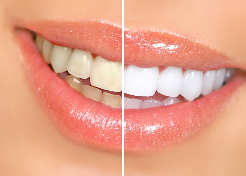 Tualatin Dental Care in Tualatin, OR